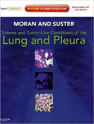 Tumors And Tumor-like Conditions Of The Lung And Pleura