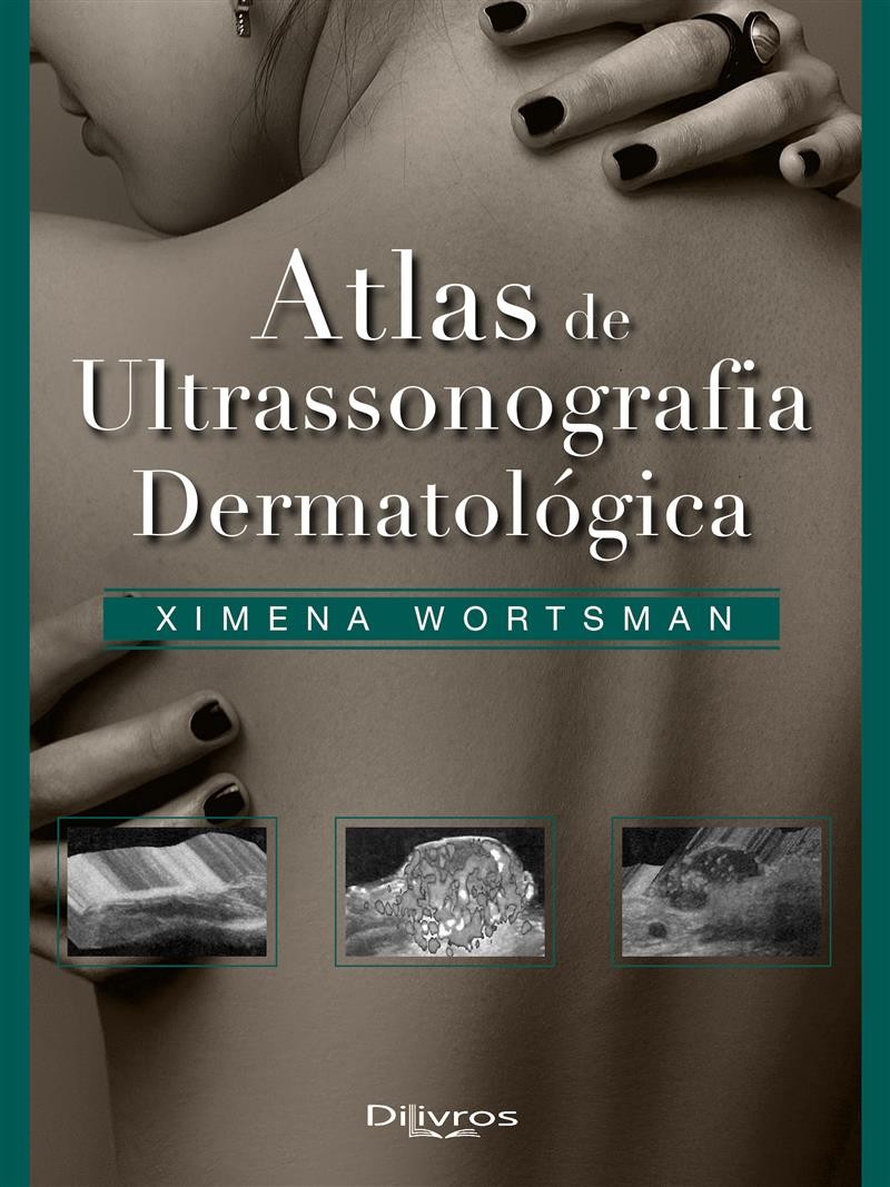 Atlas De Ultrasonografia Dermatologica