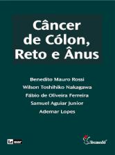 Cancer De Colon, Reto E Ânus