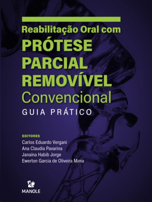 Reabilitação Oral Com Prótese Parcial Removível Convencional