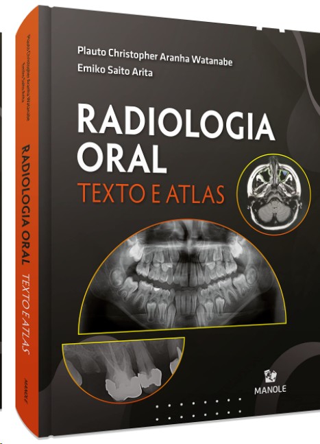 Radiologia Oral: Texto E Atlas
