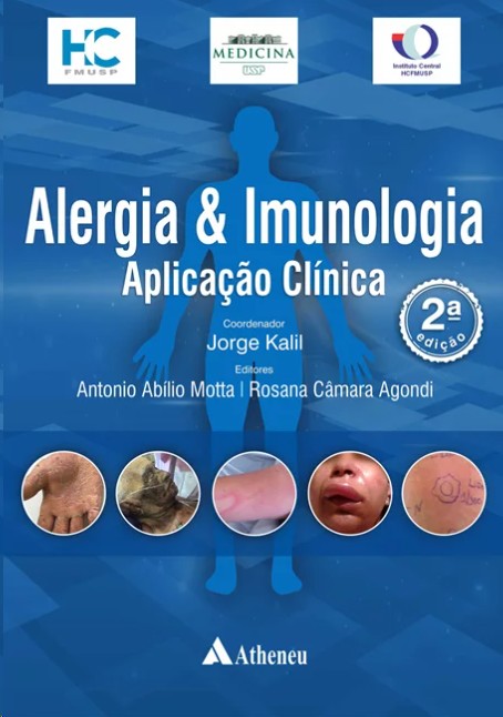 Alergia E Imunologia: Aplicação Clínica