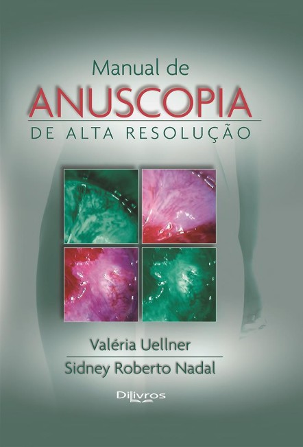 Manual De Anuscopia De Alta Resolucao