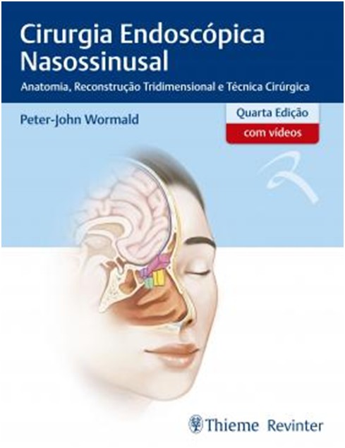 Cirurgia Endoscópica Nasossinusal