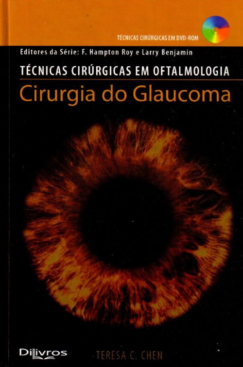 Cirurgia Do Glaucoma