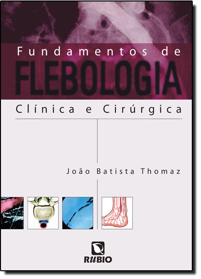 Fundamentos De Flebologia - Clínica E Cirúrgica
