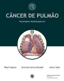Tratamento Multidisciplinar Do Câncer De Pulmão