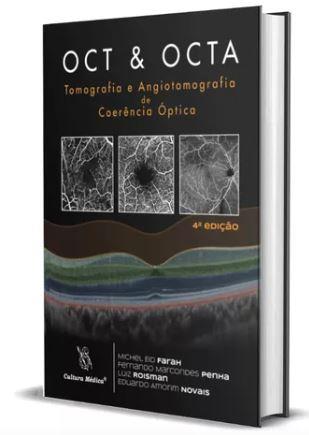 Oct & Octa -tomografia E Angiotomografia De Coerencia Optica