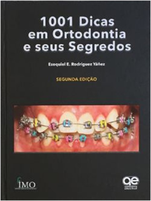 1001 Dicas Em Ortodontia E Seus Segredos