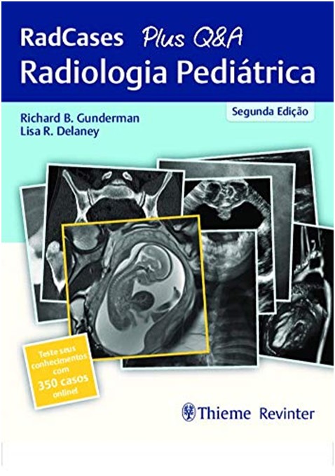 Radiologia Pediátrica: Radcases + Q&a