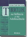 Tuberculose Na Infância E Na Adolescência