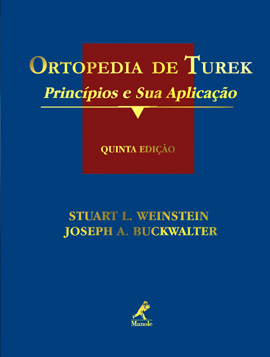 Ortopedia De Turek: Princípios E Suas Aplicações