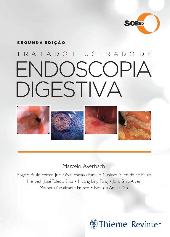 Tratado Ilustrado De Endoscopia Digestiva