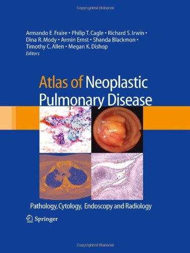 Atlas Of Neoplastic Pulmonary Disease: Pathology, Cytology, Endoscopy And R
