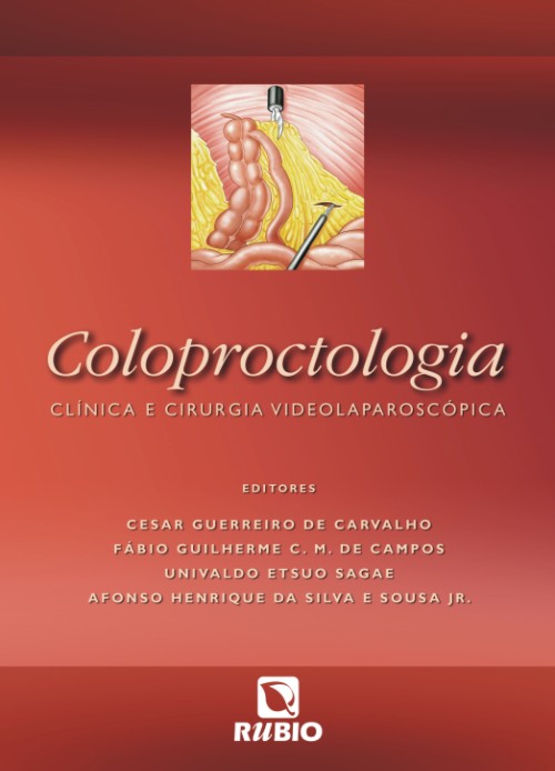 Coloproctologia - Clínica E Cirurgia Videolaparoscópica