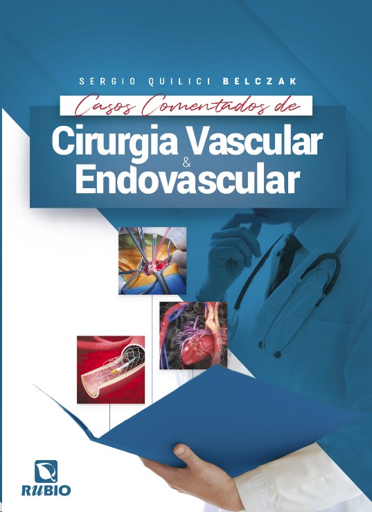 Casos Comentados De Cirurgia Vascular E Endovascular