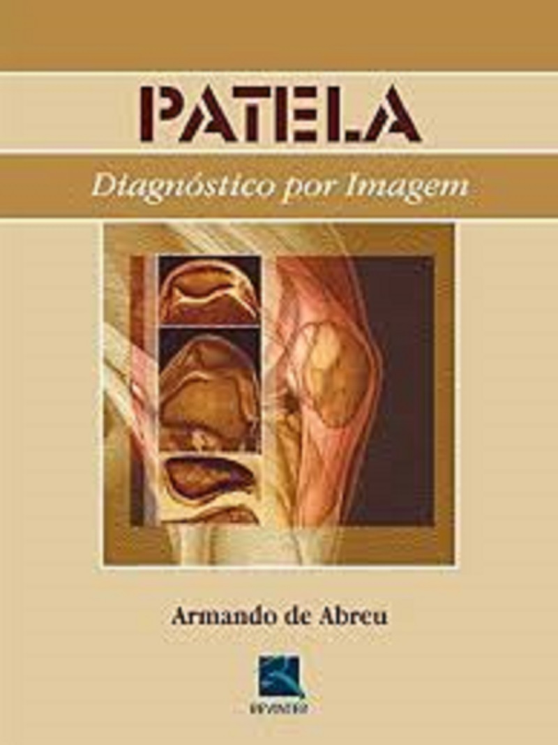 Patela - Diagnostico Por Imagem