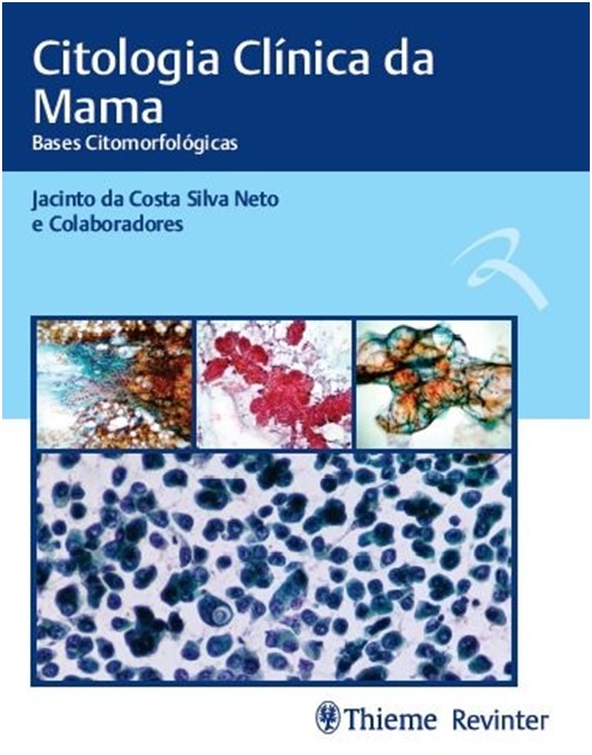 Citologia Clínica Da Mama - Bases Citomorfológicas