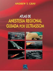 Atlas De Anestesia Regional Guiada Por Ultrason