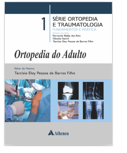 Ortopedia Do Adulto