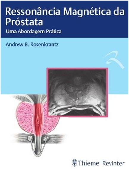 Ressonância Magnética Da Próstata - Uma Abordagem Prática
