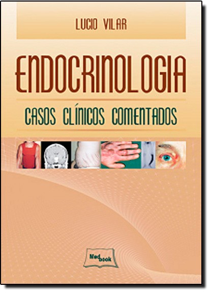 Endocrinologia - Casos Clínicos Comentados