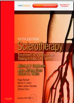 Sclerotherapy - Treatment Of Varicose And Telangiectatic Leg Veins