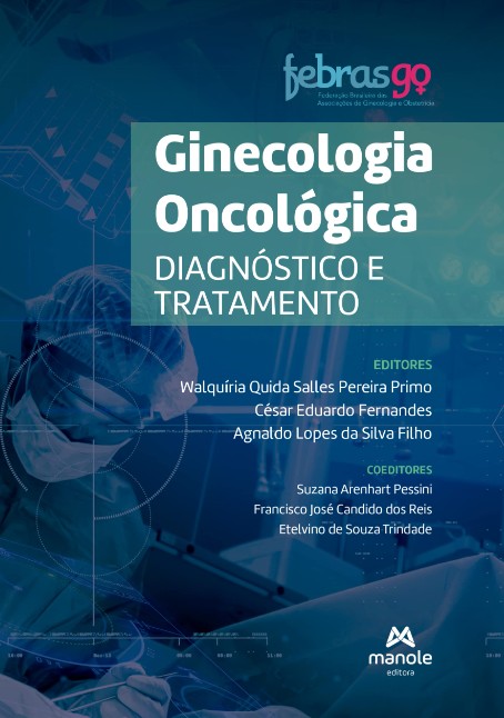 Ginecologia Oncológica: Diagnóstico E Tratamento