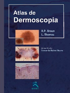 Atlas De Dermoscopia