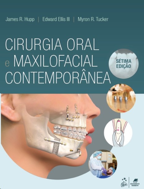 Cirurgia Oral E Maxilofacial Contemporânea