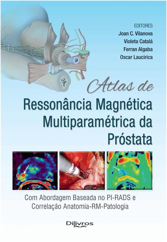 Atlas De Ressonância Magnética Multiparamétrica Da Próstata