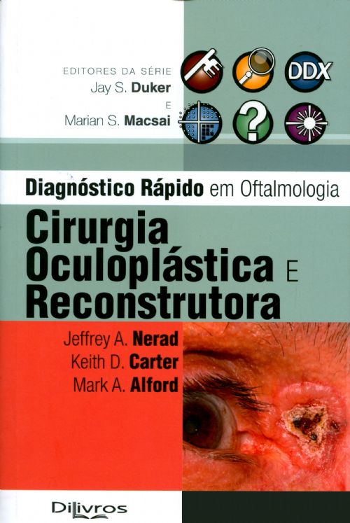 Cirurgia Oculoplástica E Reconstrutora