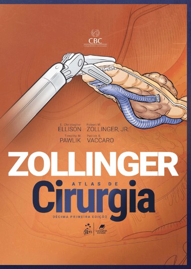 Zollinger: Atlas De Cirurgia