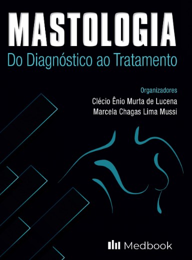 Mastologia: Do Diagnóstico Ao Tratamento