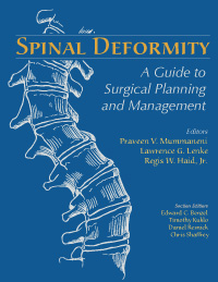 Spinal Deformity Aguide Surgical Planing And Management