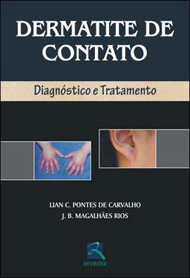 Dermatite De Contato