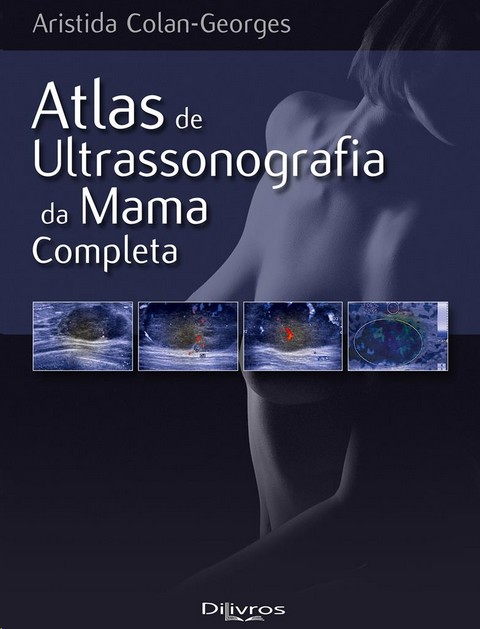 Atlas De Ultrassonografia Da Mama Completa