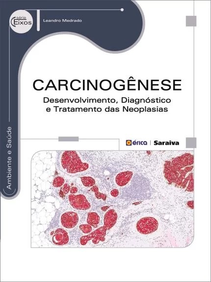 Carcinogênese - Desenvolvimento, Diagnóstico E Tratamento Das Neoplasias