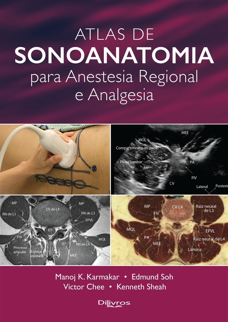 Atlas De Sonoanatomia Para Anestesia Regional E Analgesia